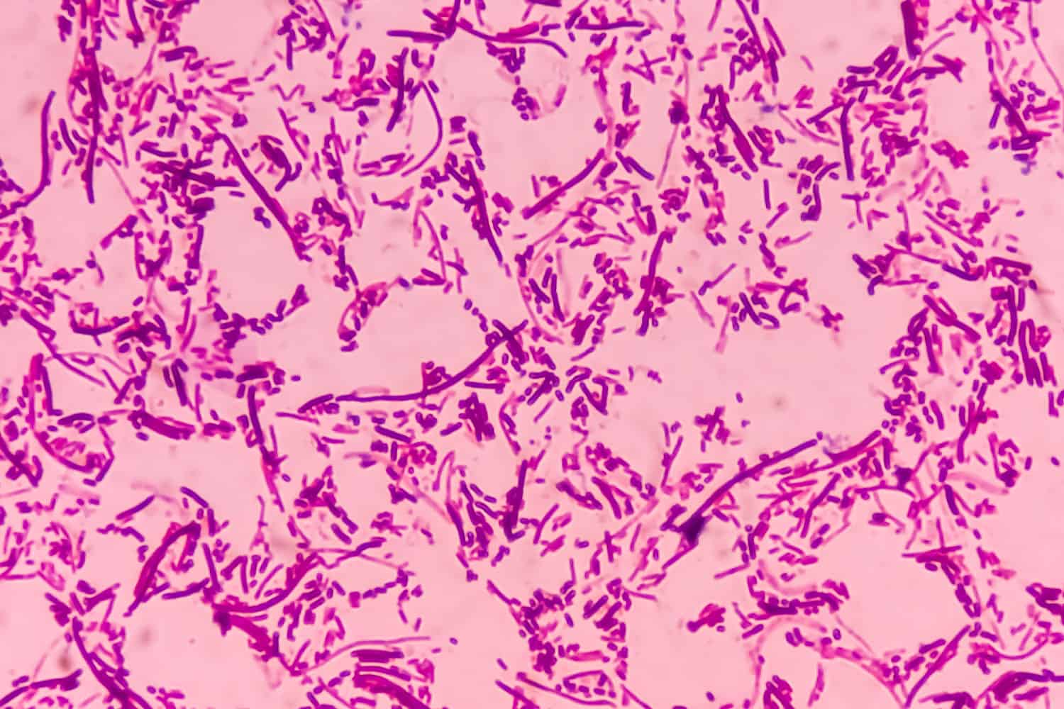 Vista microscópica de salmonelosis de un portaobjetos teñido con Gram de colonias de salmonella en agar sangre, muestra la bacteria Salmonella Typhi (S. Typhi), la enfermedad se conoce como fiebre tifoidea.
