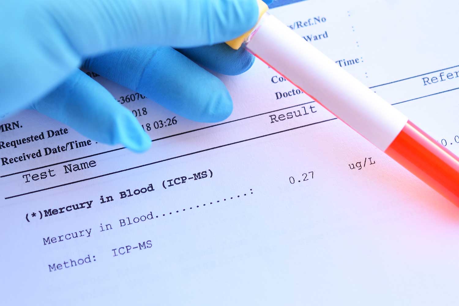 Tubo de muestra de sangre con resultado normal de la prueba de mercurio