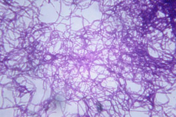 Enfermedades comunes de las ovejas - Causas y síntomas - Ántrax