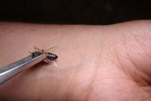 Terapia Contra Picaduras De Abeja: ¿una Alternativa De Moda Para